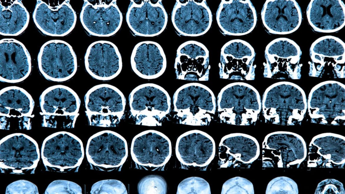 Scientists Might Be Looking for Consciousness in the Wrong Part of the Brain